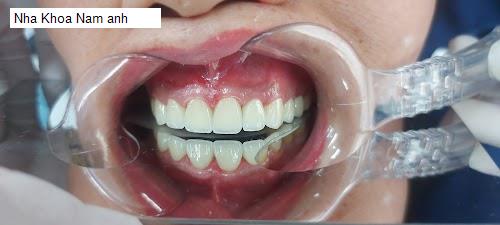 Yến Sào Hải Dương - Gợi ý 13 Nha Khoa tốt nhất khu vực Huyện Nam Sách